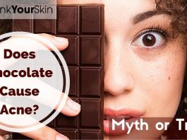 Why do Chocolate Stimulate Acne?